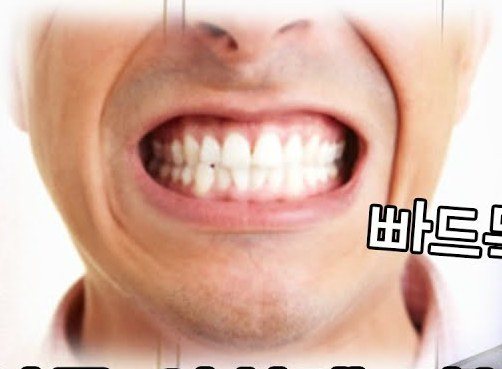 이를 강하게 악물고 있는 입 사진