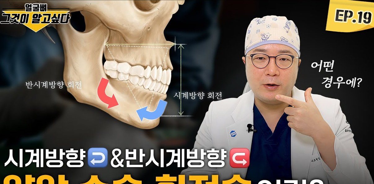 양악 수술 시계 및 반시계 회전 원리 일러스트와 설명하는 의사