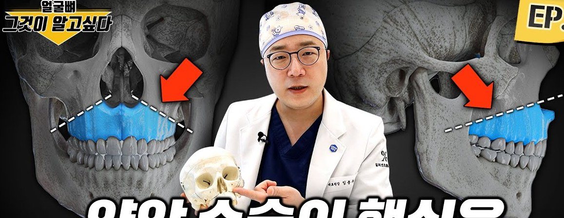 상악 수술 일러스트와 두개골 모형을 든 의사
