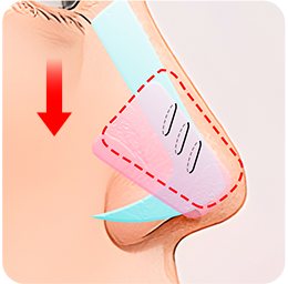 지지대가 없어 코끝이 떨어지는 코