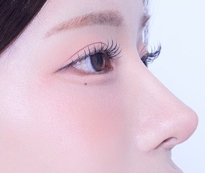 코끝 지지대로 완성한 옆모습 코 라인