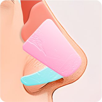 비중격 연골만 사용한 코끝 구조