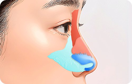 지지대 연골 코성형 측면 애니메이션