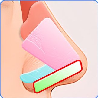 지지대 연골을 추가한 코끝 구조