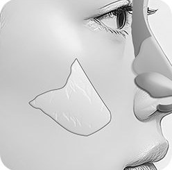일반적인 코성형 1: 비중격 연골 채취
