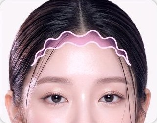 STEP 01 물결무늬 절개선 디자인 — 헤어라인을 따라 그린 물결 절개선