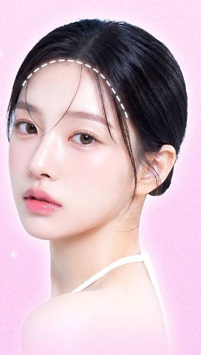 헤어라인에 점선이 그려진 모델