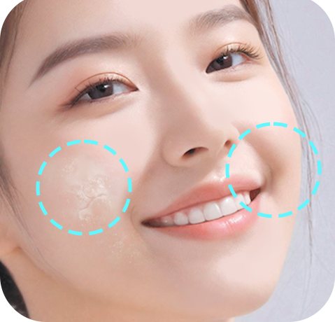 건조하고 주름진 피부 — 볼 피부 클로즈업