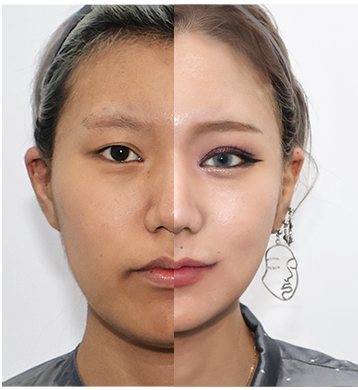정면 반반 비교 전후 사진
