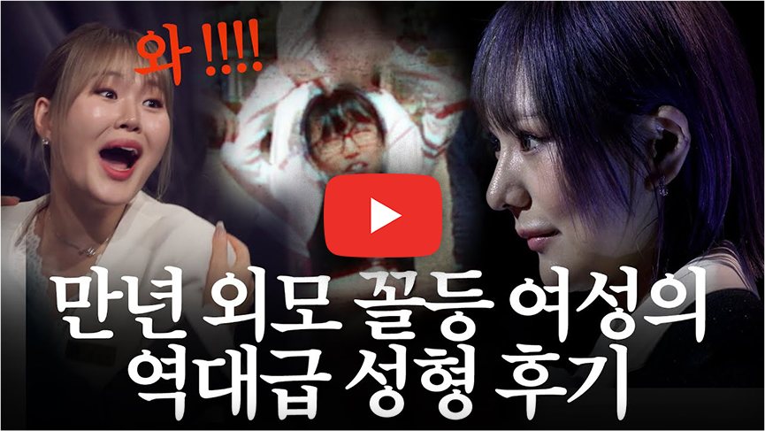 영상 썸네일 - 만년 외모 꼴등 여성의 역대급 성형 후기
