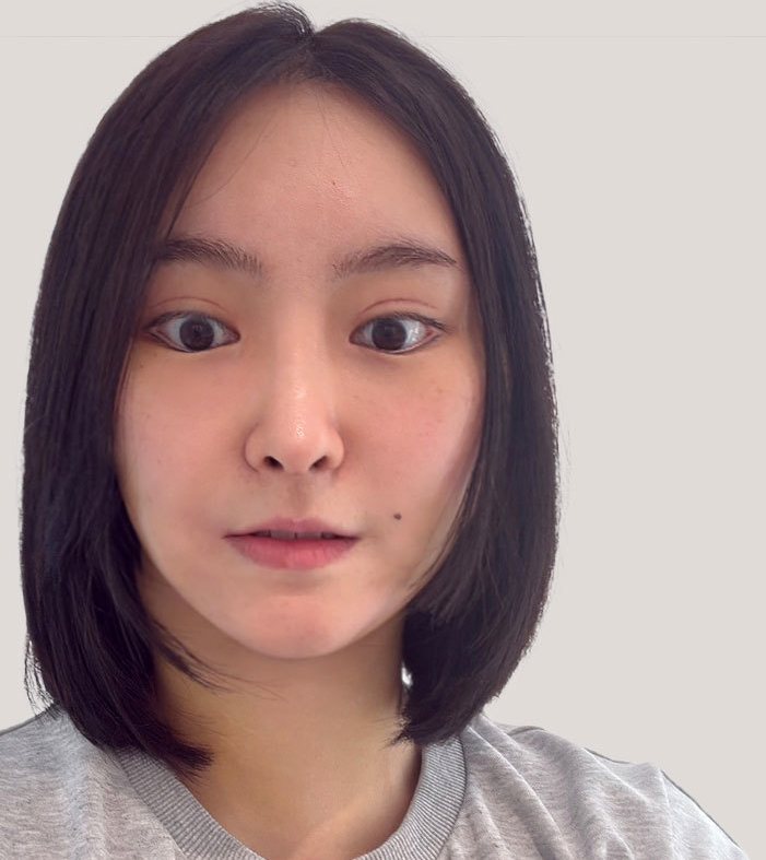 수술 후 정면