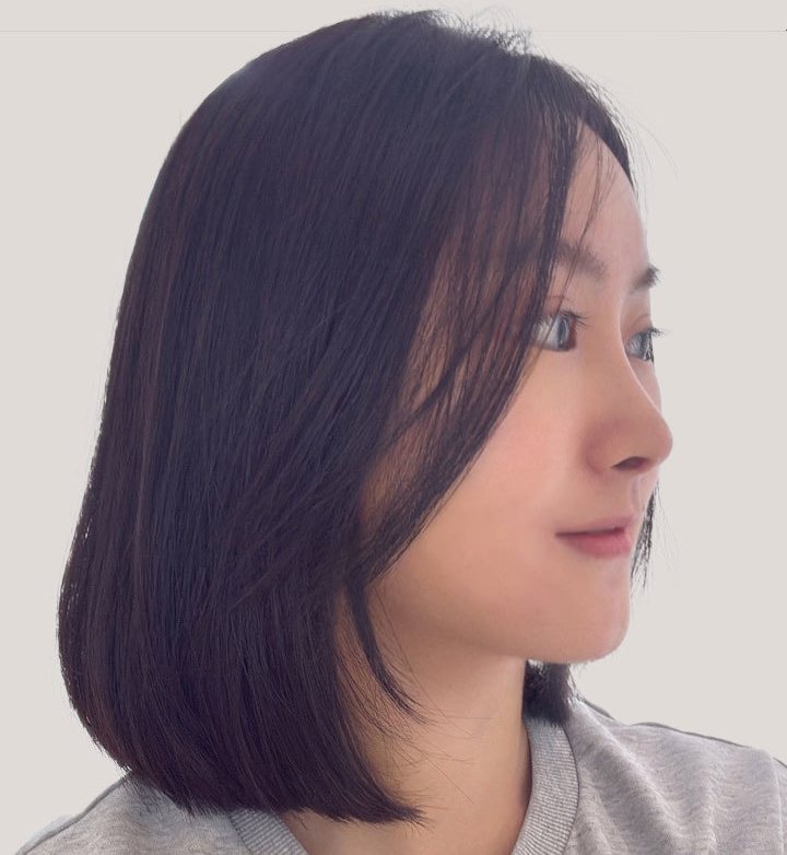 수술 후 측면