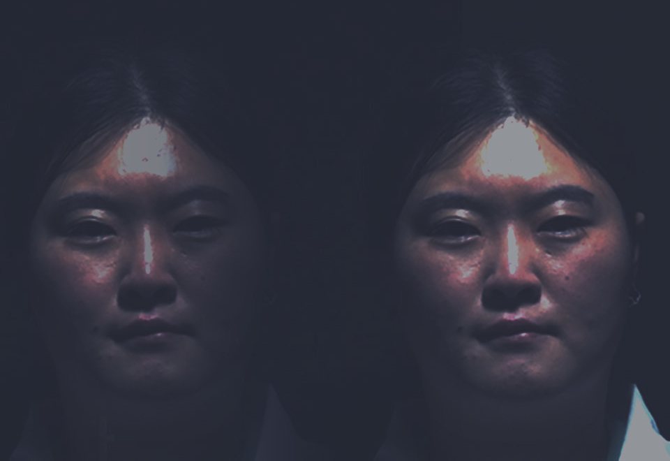 방송 장면 - 어두운 조명 속 수술 전 출연자의 굳은 표정