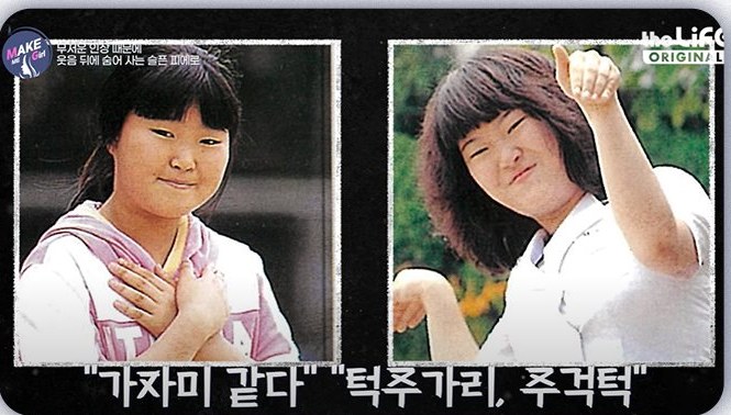 방송 장면 - 출연자의 어린 시절 사진 두 장(자막: 무서운 인상 때문에 웃음 뒤에 숨어 사는 슬픈 피에로 / “가자미 같다” “턱주가리, 주걱턱”)