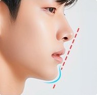 라비오멘탈커브와 리케츠 E-Line 표시 남성 측면