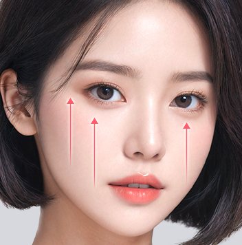 1단 수직 — 불독살 당김 방향