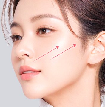 2단 사선 — 팔자주름 당김 방향
