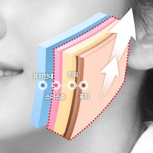 미니3단리프팅 — SMAS·표피·진피층을 한번에 당기는 단면