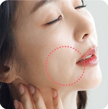 불독살 부위 표시