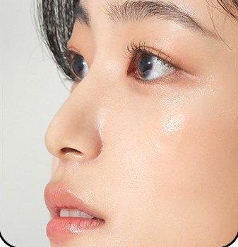 흡수가 진행 되어 변형이 생긴 코 - 여성 옆얼굴