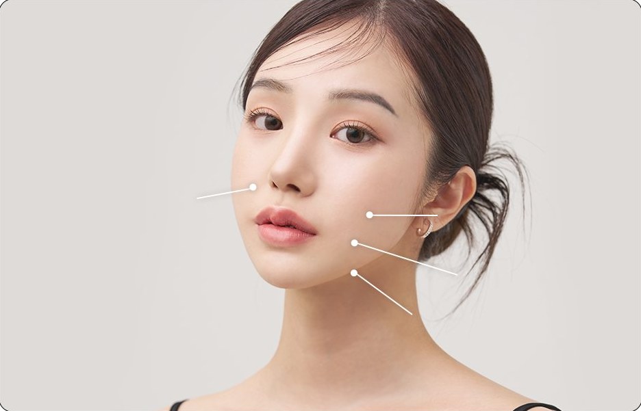 개선 부위(팔자주름·심부볼·마리오네트 주름·턱 선)를 가리키는 선이 그려진 여성 모델 얼굴