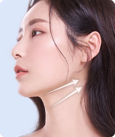 턱 밑에서 귀 쪽으로 리프팅 방향 화살표가 그려진 여성 모델 옆얼굴
