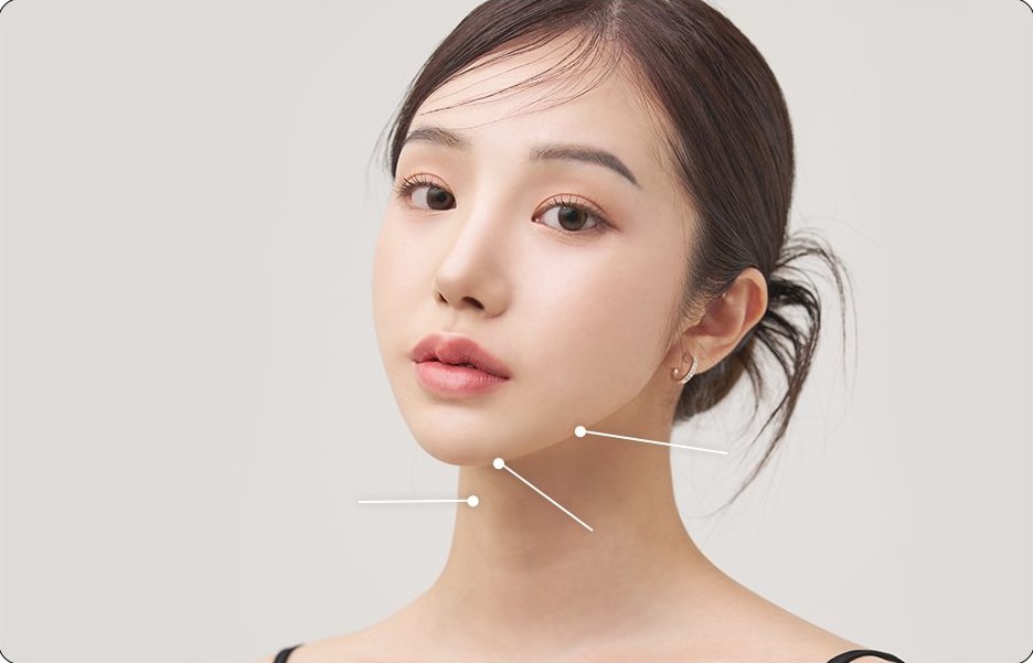 개선 부위(두꺼운 목·이중턱·턱선)를 가리키는 선이 그려진 여성 모델 얼굴