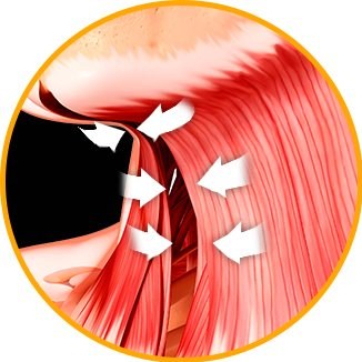 활경근을 당기는 방향(흰 화살표) 해부 일러스트
