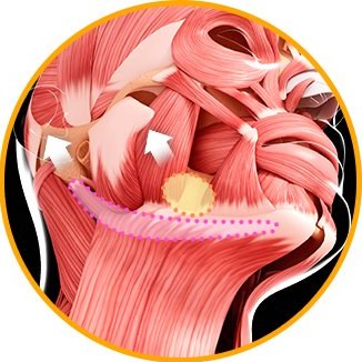 턱 밑 침샘과 늘어진 턱라인 근육을 당기는 해부 일러스트