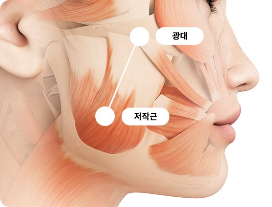 광대와 저작근의 연결을 표시한 얼굴 근육 측면 도식(라벨: 광대, 저작근)