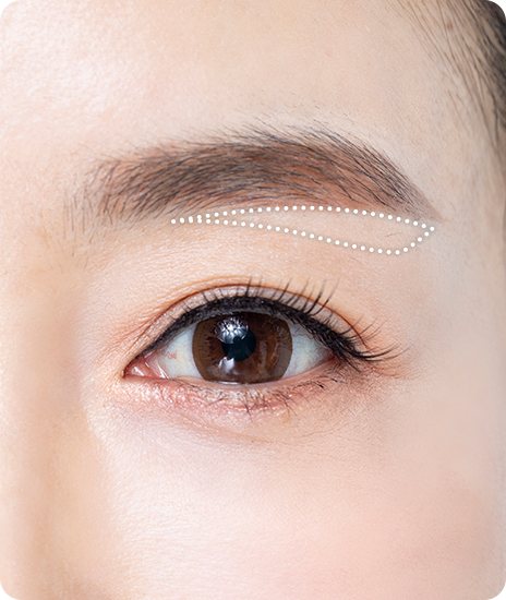 눈썹 아래 절개 디자인 점선이 그려진 눈매 사진