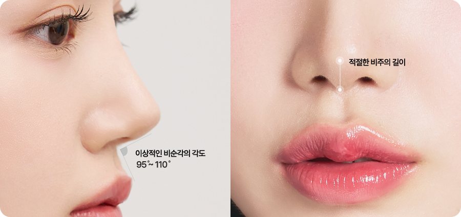 여성 옆얼굴·코끝 확대 사진 — 라벨: 이상적인 비순각의 각도 95°~110°·적절한 비주의 길이