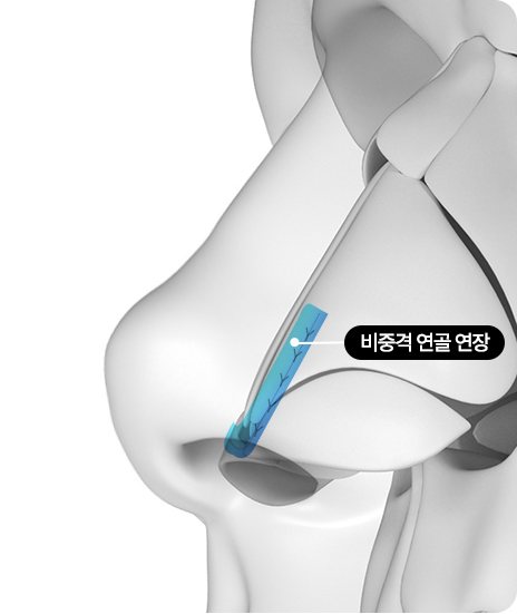 코 옆모습 단면 도식 — 라벨: 비중격 연골 연장