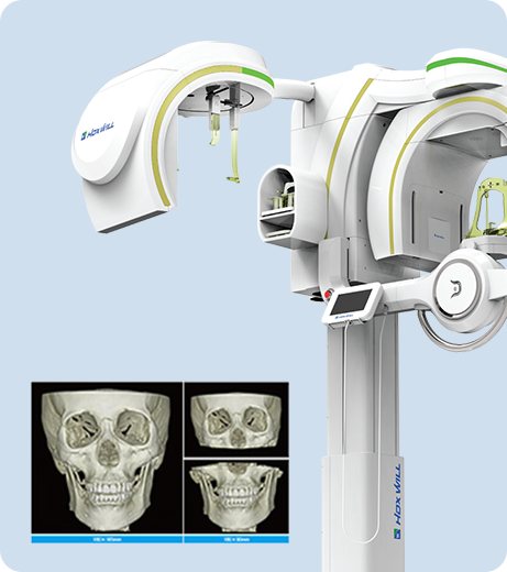 3D-CT 장비와 두개골 CT 영상