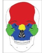 Figure 2: 복합 안면골 골절 부위를 색으로 구분한 두개골 정면 도식