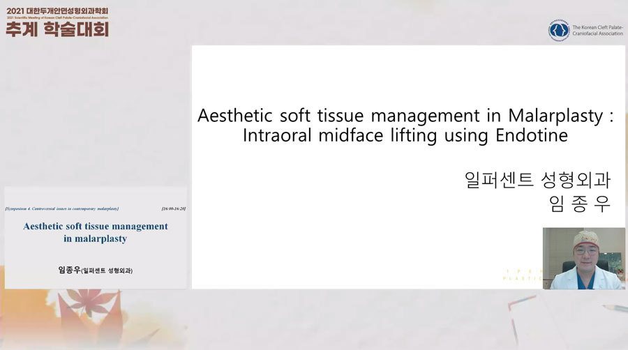 온라인 학술대회 발표 화면: Aesthetic soft tissue management in Malarplasty : Intraoral midface lifting using Endotine 표지 슬라이드와 임종우 원장