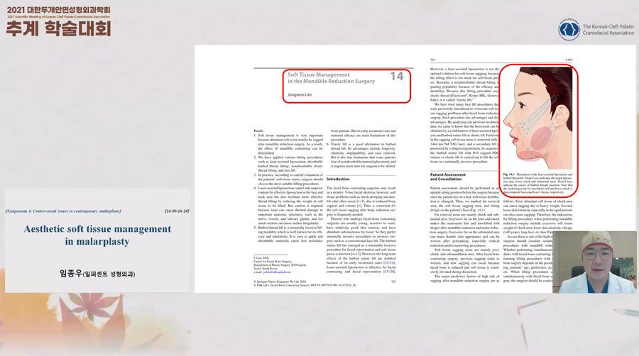 발표 화면: 교과서 14장 Soft Tissue Management in the Mandible Reduction Surgery 지면