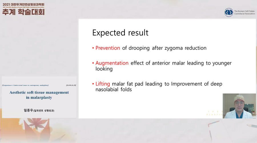 발표 화면: Expected result 슬라이드