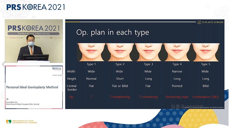 발표 화면: Op. plan in each type 슬라이드