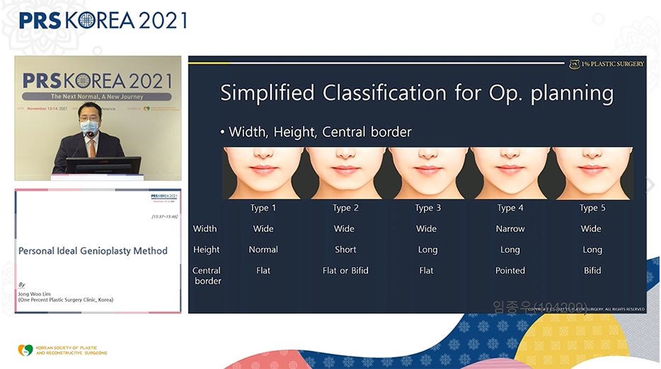 발표 화면: Simplified Classification for Op. planning 슬라이드(턱 유형 5가지)