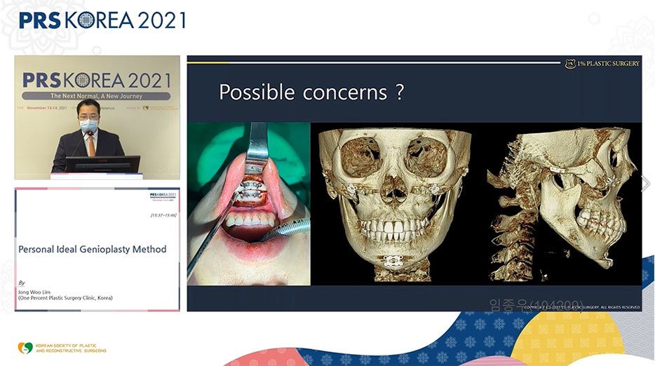 발표 화면: Possible concerns ? 슬라이드(수술 사진·3D CT)