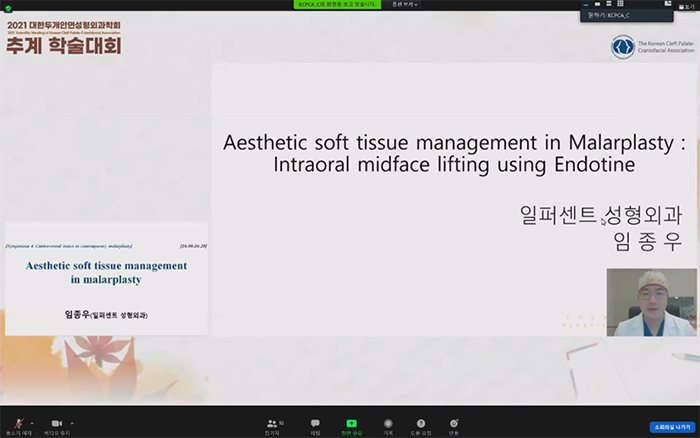 2021 대한두개안면성형외과학회 추계 학술대회 온라인 발표 화면
