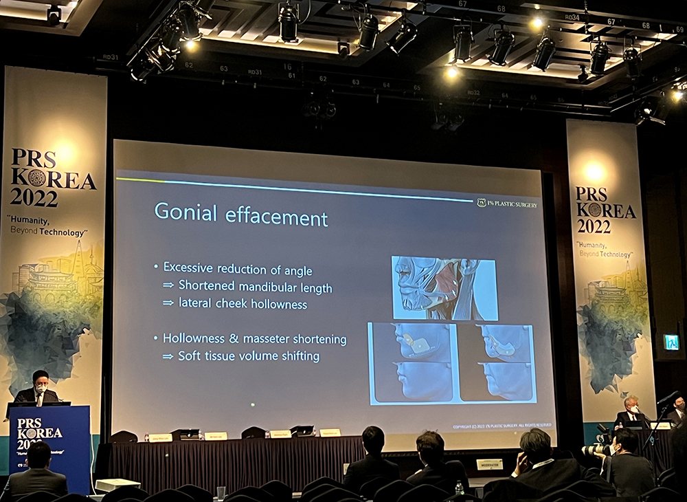 ‘Gonial effacement’ 슬라이드 발표 장면