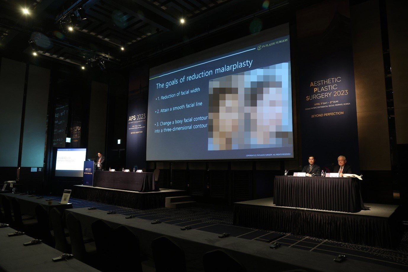 발표장 전경 — 'The goals of reduction malarplasty' 슬라이드