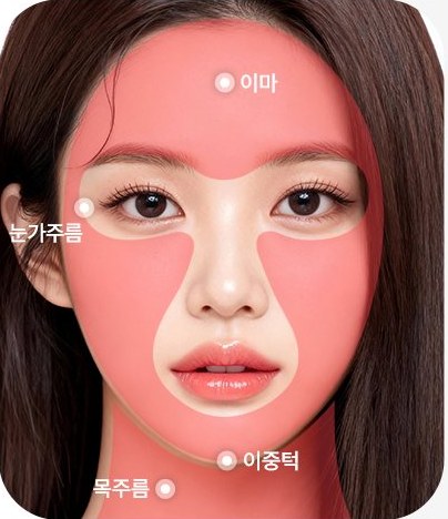 여성 얼굴 위 SHR 모드 시술 부위 표시(이마·눈가주름·이중턱·목주름)