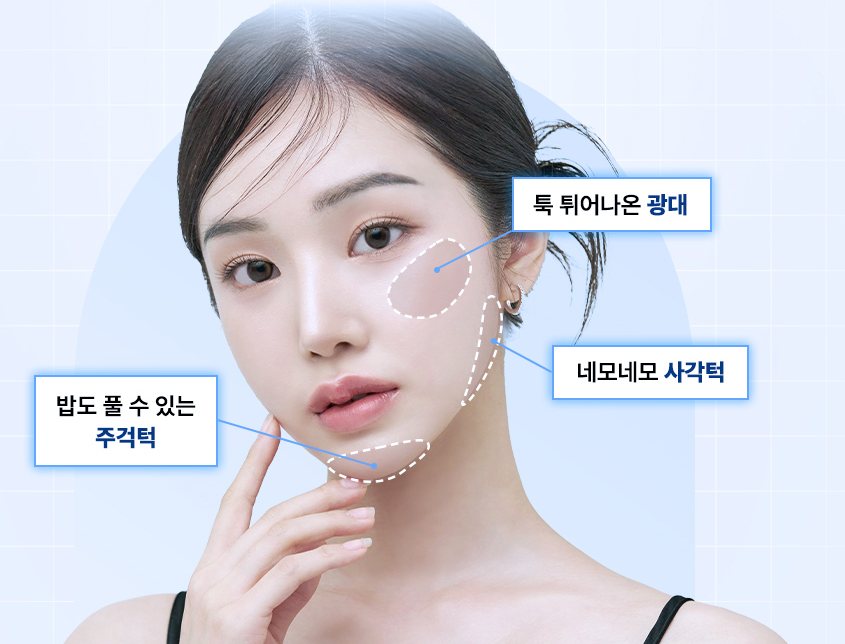 광대·사각턱·주걱턱 부위를 점선으로 표시한 여성 모델 얼굴