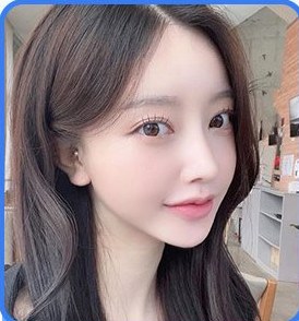 1% 양악수술 여성 모델 셀카