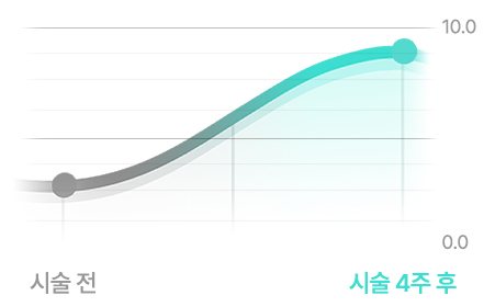 피부 속 수분 함유량 곡선 그래프(시술 전 → 시술 4주 후, 0.0~10.0)