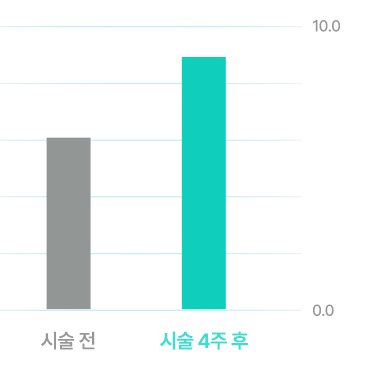피부 두께 및 치밀도 막대 그래프(시술 전·시술 4주 후, 0.0~10.0)