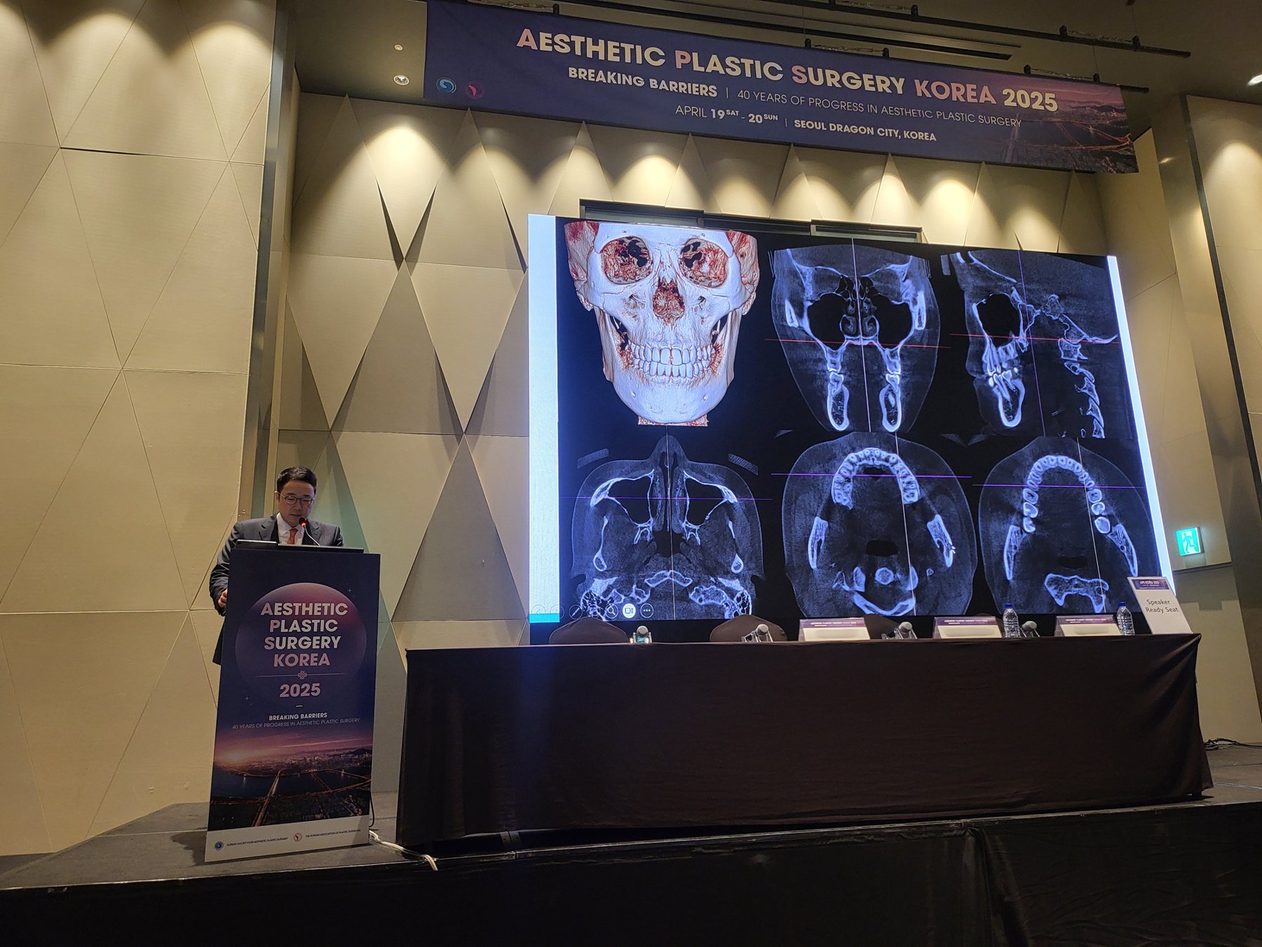 AESTHETIC PLASTIC SURGERY KOREA 2025 무대 — 3D CT·단층 영상 슬라이드 앞에서 발표하는 임종우 대표원장
